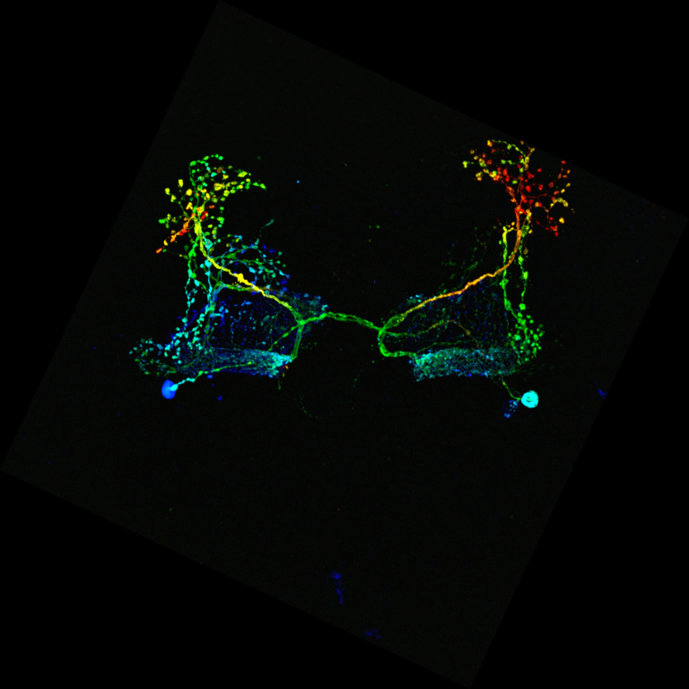 New insights after 180 years shed light on the mechanism of general anaesthesia in the brain