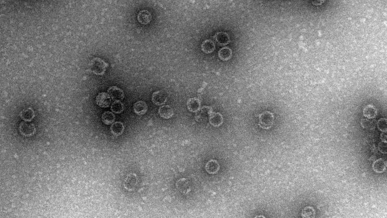 Black and white image showing small circular blobs against a scale bar marked'200 nm'.