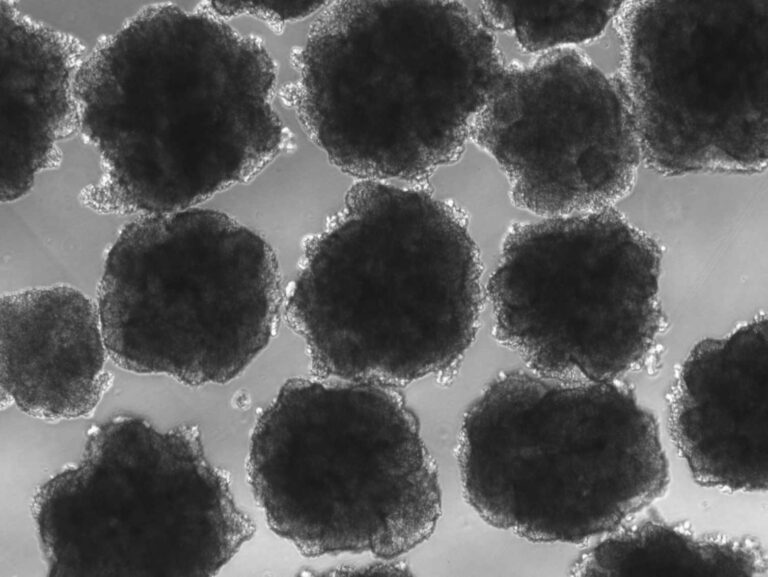 Human ancestors were exposed to lead millions of years ago, and it shaped our evolution