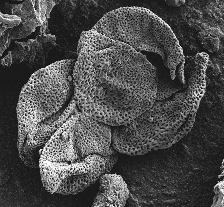 A black and white microscopic image of a pockmarked piece of pollen.
